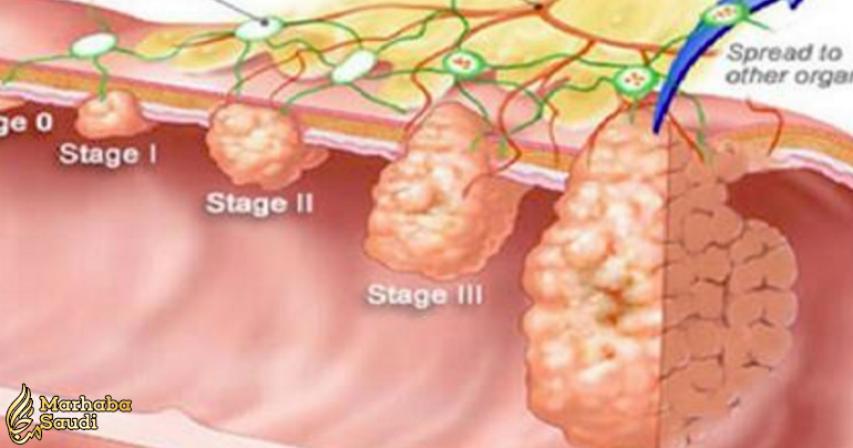 The Cancer Dies When You Eat These Five Foods, It's Time To Start Eating Them