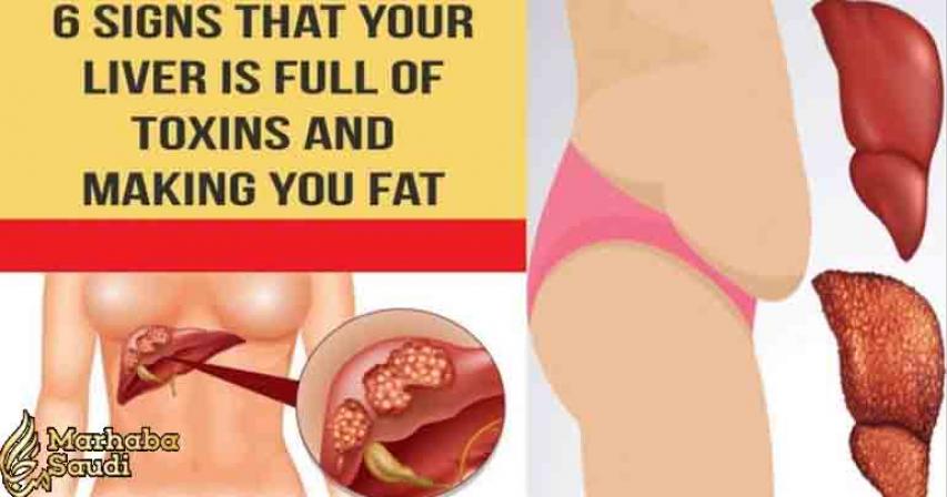 6 Signs That Indicate Your Liver Is Full of Toxins and Making You Fat