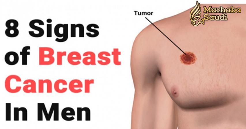 8 Signs of Breast Cancer In Men