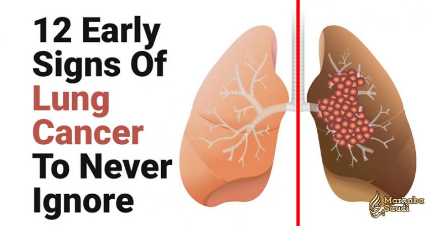 12 Early Signs Of Lung Cancer To Never Ignore