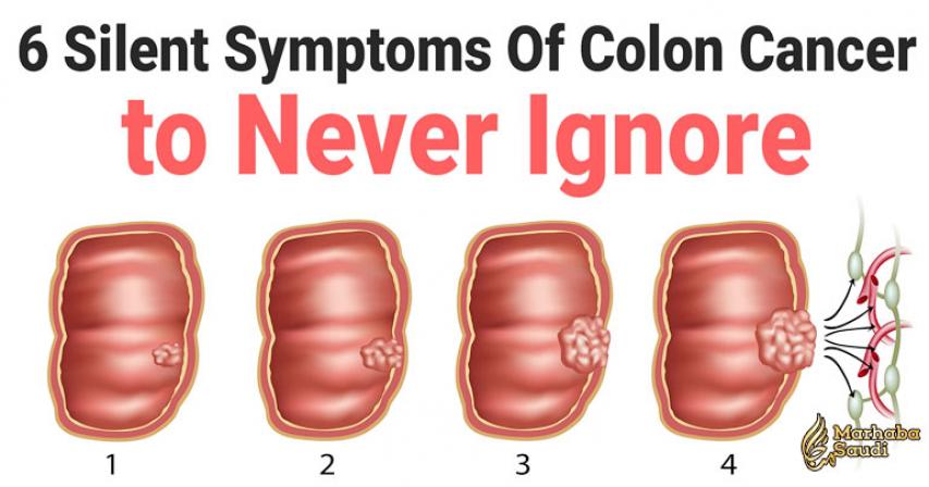 6 Silent Symptoms Of Colon Cancer to Never Ignore