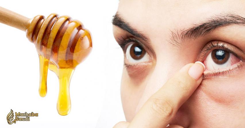 10 Ways to Relieve Eye Pain Naturally