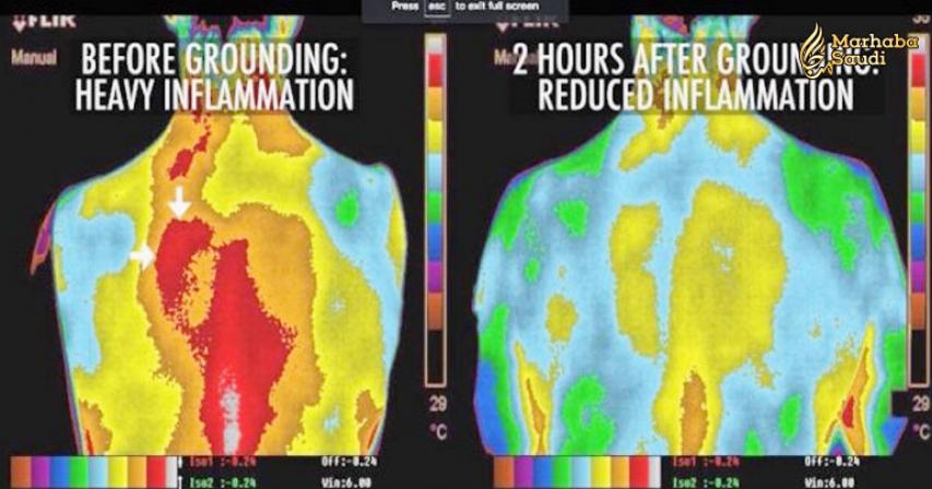 How To Reduce Inflammation In Your Body, Re-Energize, And Improve Your Blood Pressure At Zero Cost
