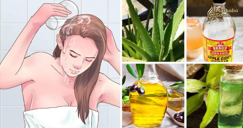 12 Ways To Naturally Cure Dandruff Without Buying Expensive/ Chemical-Laced Shampoo