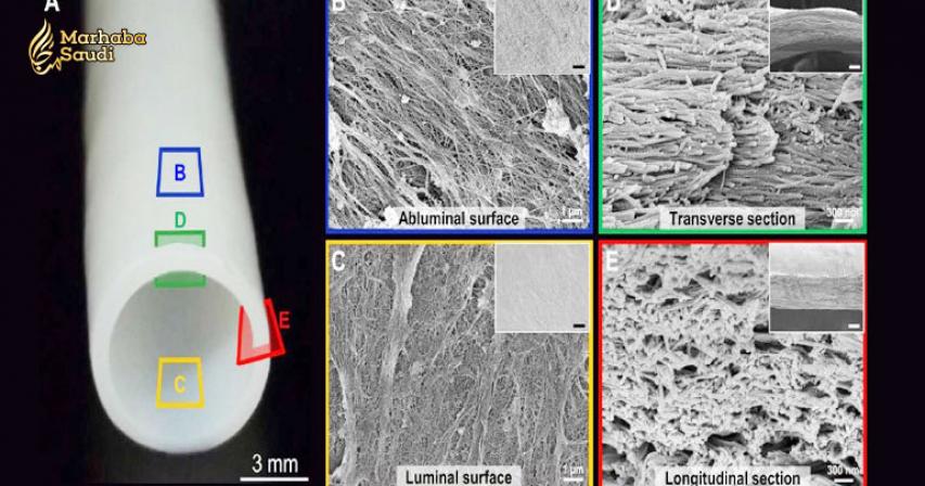 Scientists Make Blood Vessels From Cadaver Tissues And Bring Them to Life in Patients
