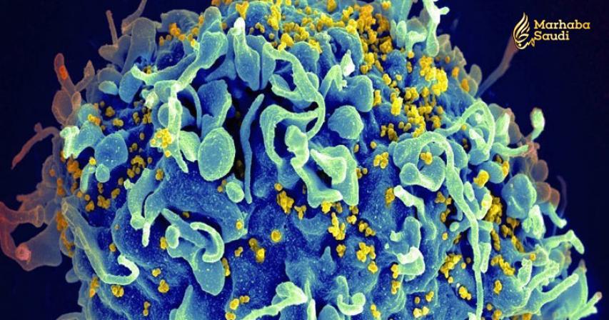 First-of-Its-Kind HIV Therapy Kicks The Virus Out of Hiding, And Then Kills It