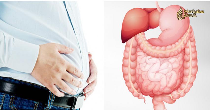 8 Causes Of Bloated Stomach and Natural Remedies