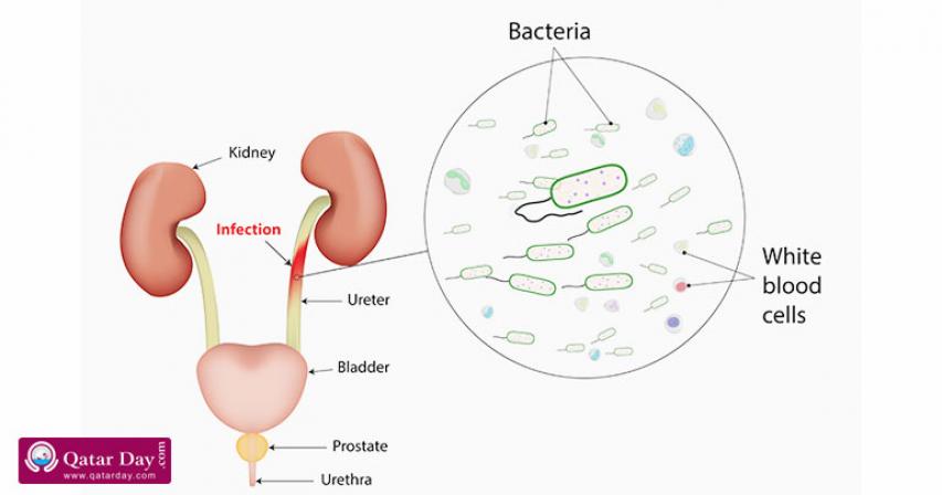 Apple Cider Vinegar For Urinary Tract Infections (UTI): Does It Reduce The Risk Factors?