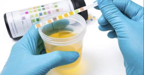 What Does The Color Of Your Urine Say About Your Wellness