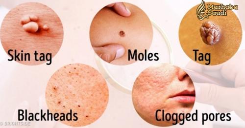 8 Serious Diseases That Are Signaled By Our Skin