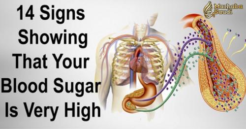 14 symptoms of high blood sugar and which foods reduce it