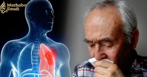 Lung cancer symptoms: If this happens to your fingers you could have the deadly disease