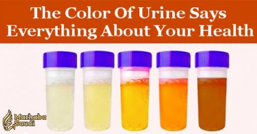 The Color Of Urine Says Everything About Your Health