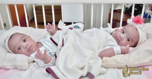 Saudi conjoined twins to be separated today