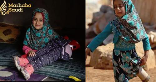 Syrian girl born without legs walks on new prosthetics