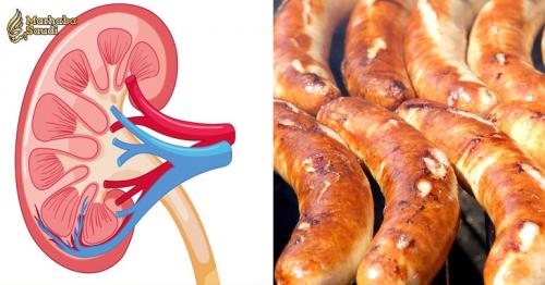 Avoid These 7 Kidney-Damaging Foods