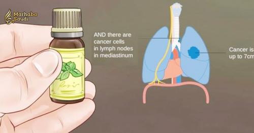 The Truth About Cancer and Essential Oils: What NO Oncologist Will Tell You