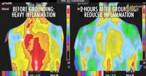 How To Reduce Inflammation In Your Body, Re-Energize, And Improve Your Blood Pressure At Zero Cost