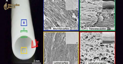 Scientists Make Blood Vessels From Cadaver Tissues And Bring Them to Life in Patients